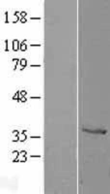 Western Blot: Cathepsin X/Z/P Overexpression Lysate [NBL1-09599]