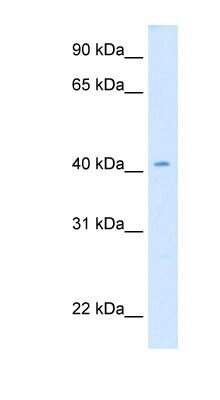 Western Blot: Caudal Antibody [NBP1-56308]