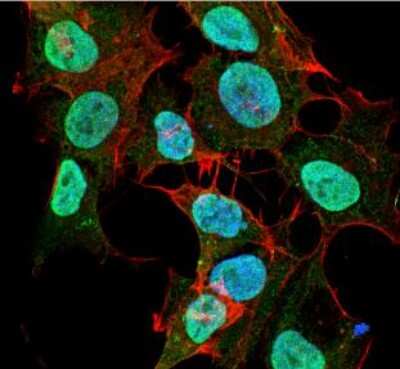 Immunocytochemistry/ Immunofluorescence: Cav1.2 Antibody (S57) [NBP1-22439]