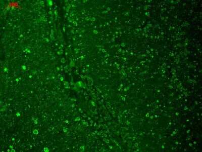 Immunohistochemistry: Cav1.2 Antibody (S57) [NBP1-22439]