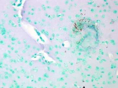 Immunohistochemistry: Cav1.2 Antibody (S57) [NBP1-22439]