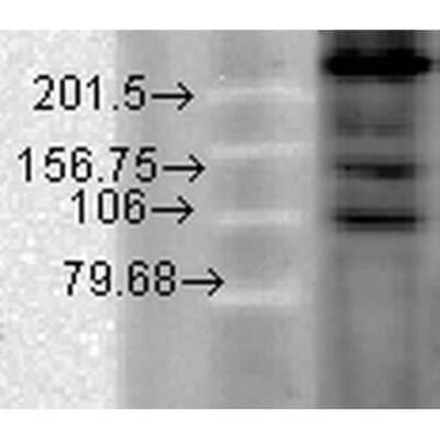 Western Blot: Cav1.2 Antibody (S57) [NBP1-22439]