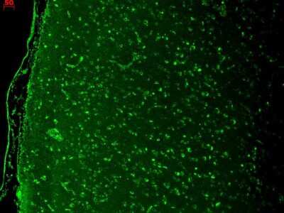 Immunohistochemistry: Cav1.3 Antibody (S48) [NBP2-12893]