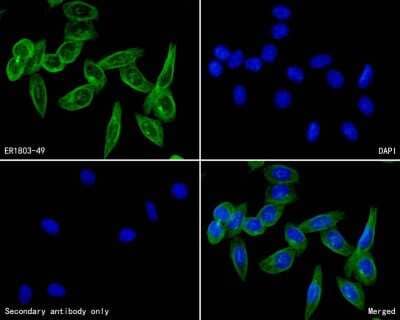 Immunocytochemistry/ Immunofluorescence: Cav1.2 Antibody [NBP2-76914]