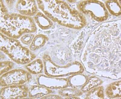 Immunohistochemistry-Paraffin: Cav1.2 Antibody [NBP2-76914]