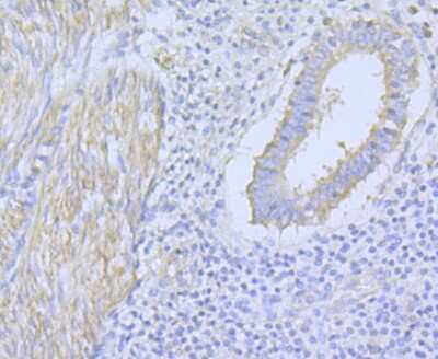 Immunohistochemistry-Paraffin: Cav1.2 Antibody [NBP2-76914]