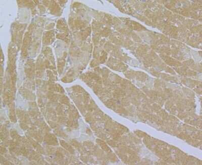 Immunohistochemistry-Paraffin: Cav1.2 Antibody [NBP2-76914]