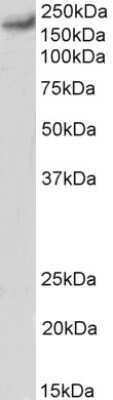 Western Blot: Cav1.2 Antibody [NBP1-20896]