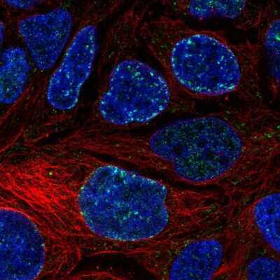 Immunocytochemistry/ Immunofluorescence: Cav1.3 Antibody [NBP1-86684]