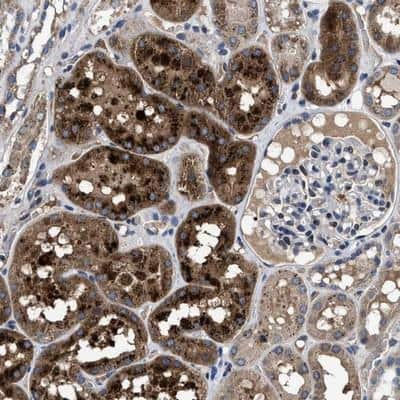 Immunohistochemistry-Paraffin: Cav1.3 Antibody [NBP1-86684]