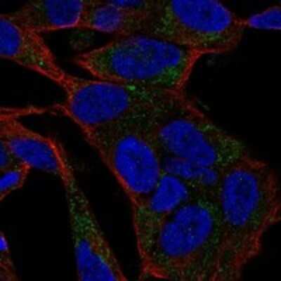 Immunocytochemistry/ Immunofluorescence: Cav2.2 Antibody [NBP3-17353]