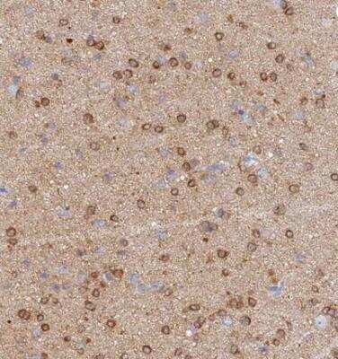 Immunohistochemistry-Paraffin: Cav2.2 Antibody [NBP1-91744]