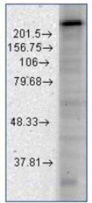 Western Blot: Cav3.2 Antibody (S55/10) [NBP1-22444]