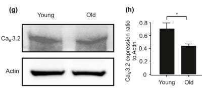 Western Blot: Cav3.2 Antibody (S55/10) [NBP1-22444]