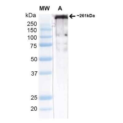 Western Blot: Cav3.2 Antibody (S55/10) [NBP1-22444]