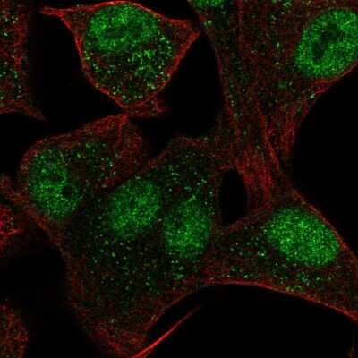 Immunocytochemistry/ Immunofluorescence: Cav3.2 Antibody [NBP1-88176]