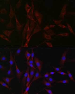 Immunocytochemistry/ Immunofluorescence: Cav3.2 Antibody - Azide and BSA Free [NBP3-15334]