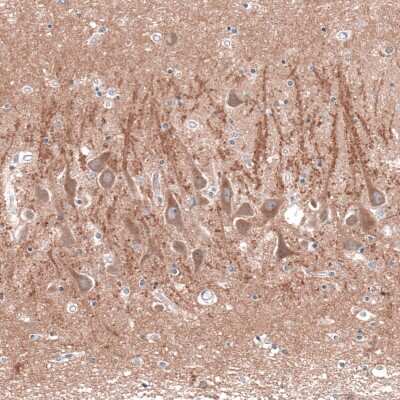 Immunohistochemistry-Paraffin: Cav3.2 Antibody [NBP1-88176]