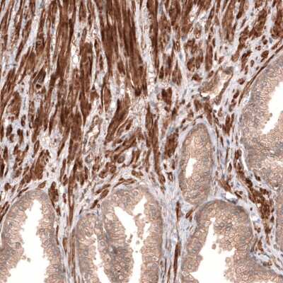 Immunohistochemistry-Paraffin: Cav3.2 Antibody [NBP1-88176]