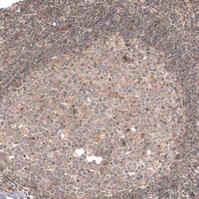 Immunohistochemistry-Paraffin: Cav3.2 Antibody [NBP1-88176]