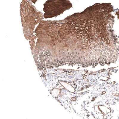 Immunohistochemistry-Paraffin: Cav3.2 Antibody [NBP1-88176]