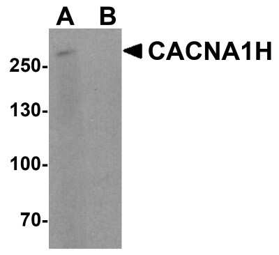 Western Blot: Cav3.2 AntibodyBSA Free [NBP2-41303]