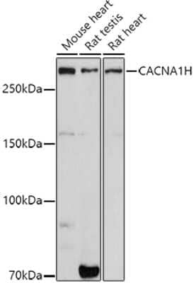 Western Blot: Cav3.2 AntibodyAzide and BSA Free [NBP3-15334]