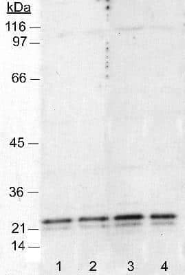 Western Blot: Caveolin-1 Antibody (7C8) [NB100-615]