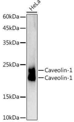 Western Blot: Caveolin-1 Antibody (10Y5L2) [NBP3-15615]