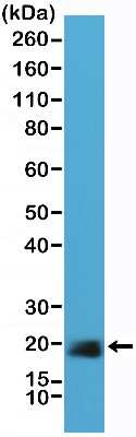 Western Blot: Caveolin-1 Antibody (RM325) [NBP2-77410]