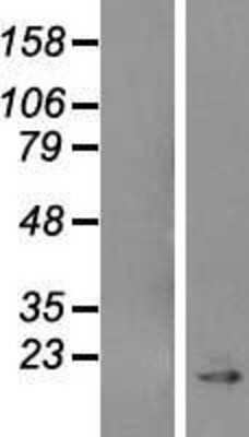 Western Blot: Caveolin-1 Overexpression Lysate [NBL1-08729]