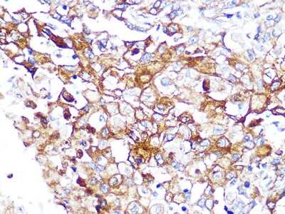Immunohistochemistry-Paraffin: Caveolin-2 Antibody (8I4U7) [NBP3-16502]