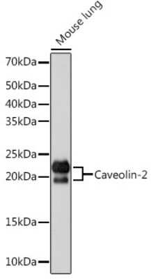 Western Blot: Caveolin-2 Antibody (8I4U7) [NBP3-16502]