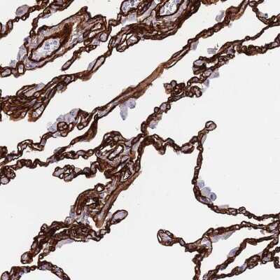 Immunohistochemistry-Paraffin: Caveolin-2 Antibody [NBP2-33431]