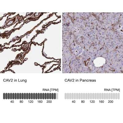 Immunohistochemistry-Paraffin: Caveolin-2 Antibody [NBP2-33431]