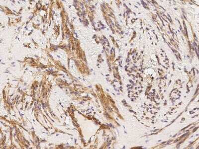 Immunohistochemistry-Paraffin: Caveolin-2 Antibody [NBP2-98731]