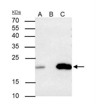Immunoprecipitation: Caveolin-2 Antibody [NBP1-31116]