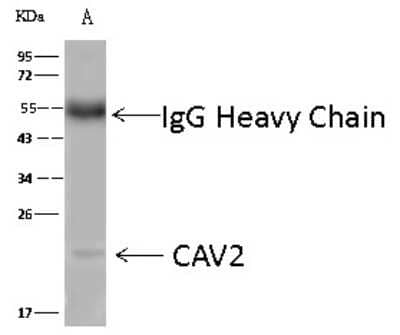 Immunoprecipitation: Caveolin-2 Antibody [NBP2-99542]