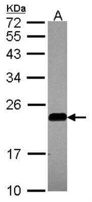 Western Blot: Caveolin-2 Antibody [NBP1-31116]