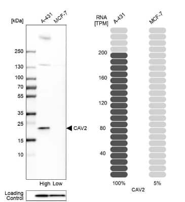 Western Blot: Caveolin-2 Antibody [NBP2-33431]