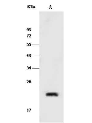 Western Blot: Caveolin-2 Antibody [NBP2-99448]