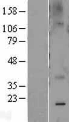 Western Blot: Caveolin-2 Overexpression Lysate [NBL1-08730]