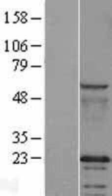 Western Blot: Caveolin-2 Overexpression Lysate [NBL1-08731]