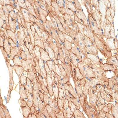 Immunohistochemistry-Paraffin: Caveolin-3 Antibody (4G5W2) [NBP3-16503]