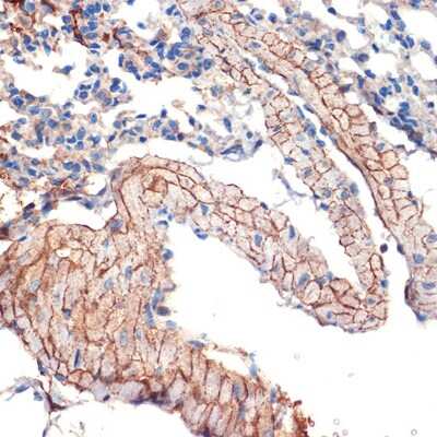 Immunohistochemistry-Paraffin: Caveolin-3 Antibody (4G5W2) [NBP3-16503]