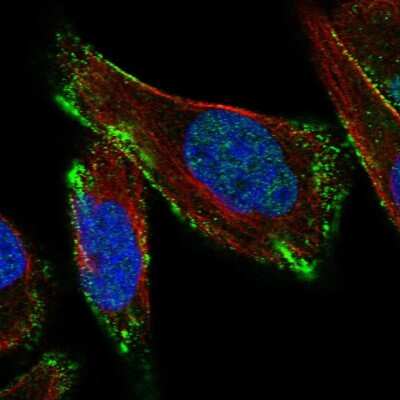 Immunocytochemistry/ Immunofluorescence: Caveolin-3 Antibody [NBP2-58553]