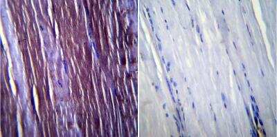 Immunohistochemistry-Paraffin: Caveolin-3 Antibody [NB110-5029]