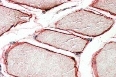 Immunohistochemistry-Paraffin: Caveolin-3 Antibody [NBP1-28917]