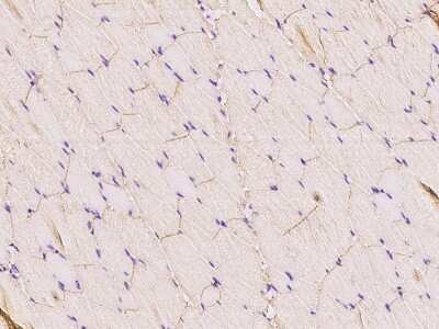 Immunohistochemistry-Paraffin: Caveolin-3 Antibody [NBP2-98712]