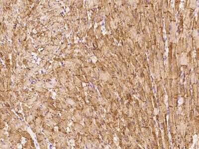 Immunohistochemistry-Paraffin: Caveolin-3 Antibody [NBP2-98712]